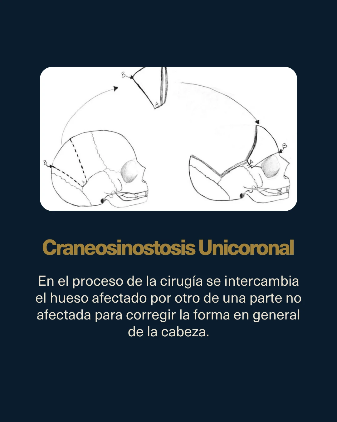 Médico puertorriqueño realiza cirugías de alto nivel para tratar craneosinostosis en bebés en Puerto Rico
